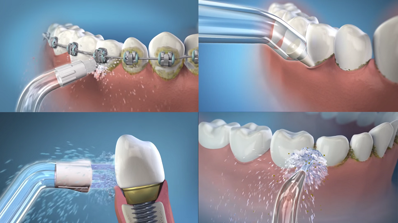 Kinh nghiệm mua máy tăm nước tốt, giá rẻ phù hợp với mọi người